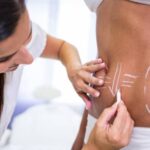 liposuction Washington DC
