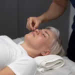 Acupuncture therapist