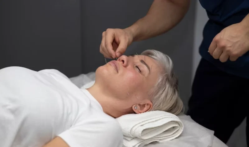 Acupuncture therapist