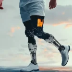 robotic knee replacement surgery
